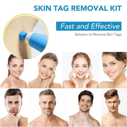 TagErase™ Skin Tag Remover Kit