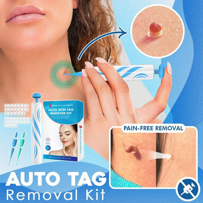 TagErase™ Skin Tag Remover Kit